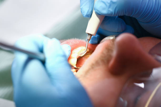 Best Dentist Open Late Near Me  in Perryman, MD