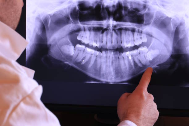Best Emergency Dentist Near Me  in Perryman, MD