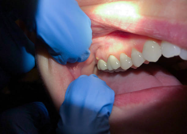 Best Emergency Dentist Near Me  in Perryman, MD